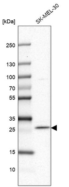 Western blot analysis in human cell line SK-MEL-30.