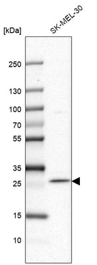 Western blot analysis in human cell line SK-MEL-30.