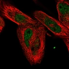 Immunofluorescent staining of human cell line RH-30 shows localization to nucleoplasm.