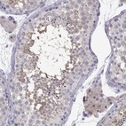 Anti-CFAP70 Antibody