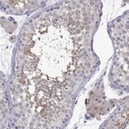 Anti-CFAP70 Antibody