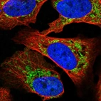 Anti-SLC16A12 Antibody