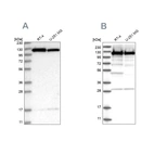 Western blot analysis using Anti-KIF5B antibody HPA037589 (A) shows similar pattern to independent antibody HPA037590 (B).