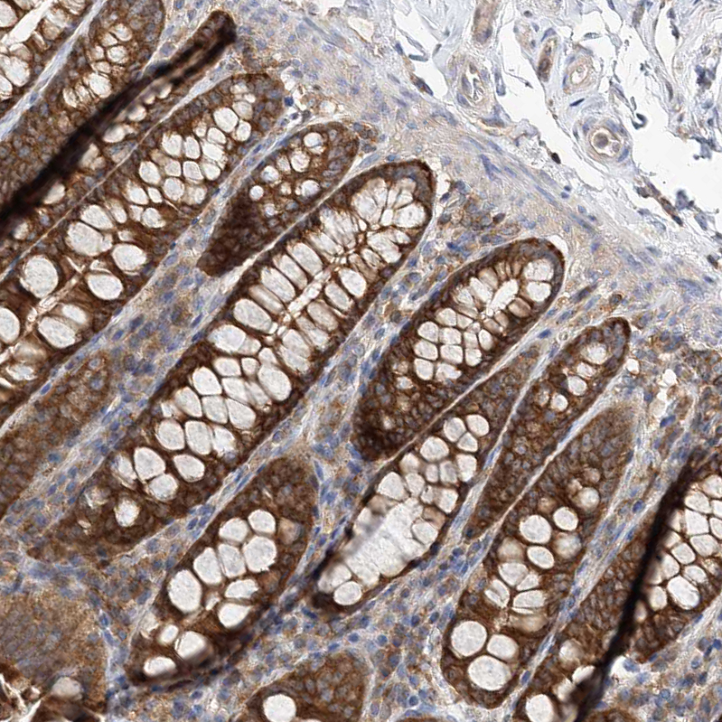 Anti-FAM175B Antibody