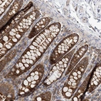 Anti-FAM175B Antibody
