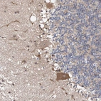 Immunohistochemical staining of human cerebellum shows moderate cytoplasmic positivity in Purkinje cells.