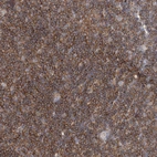 Immunohistochemical staining of human tonsil shows moderate cytoplasmic positivity in non-germinal center cells.