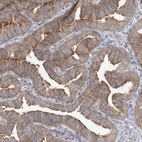 Immunohistochemical staining of human fallopian tube shows moderate cytoplasmic positivity in glandular cells.