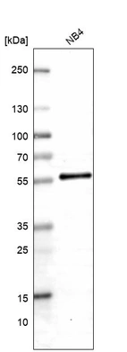 Western blot analysis in human cell line NB4.
