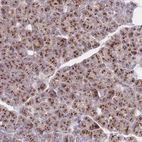 Anti-FAM175B Antibody