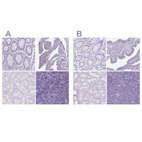 Anti-ENKUR Antibody