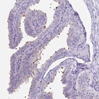 Immunohistochemical staining of human fallopian tube shows moderate positivity in ciliated cells.