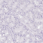 Immunohistochemical staining of human kidney shows no positivity in cells in tubules as expected.