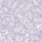 Immunohistochemical staining of human kidney shows no positivity in cells in tubules as expected.