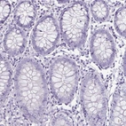 Immunohistochemical staining of human colon shows no positivity in glandular cells as expected.
