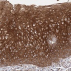 Immunohistochemical staining of human esophagus shows high expression.