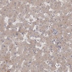 Immunohistochemical staining of human liver shows low expression as expected.