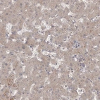 Immunohistochemical staining of human liver shows low expression as expected.
