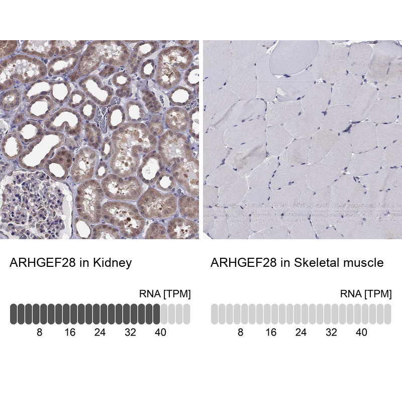 Anti-ARHGEF28 Antibody