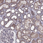 Immunohistochemical staining of human kidney shows high expression.