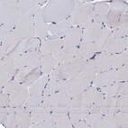 Immunohistochemical staining of human skeletal muscle shows low expression as expected.