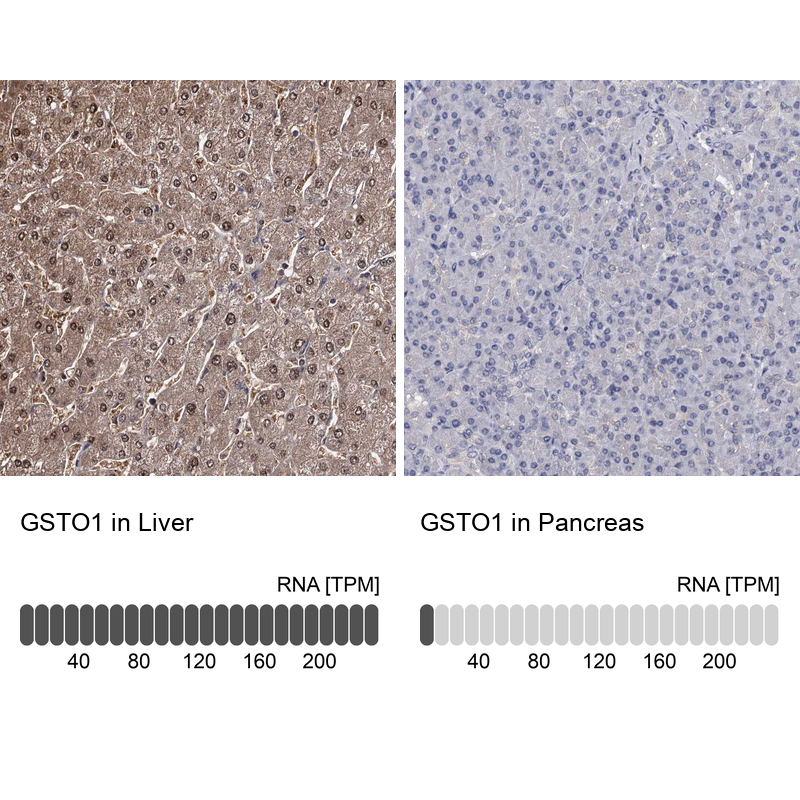 Anti-GSTO1 Antibody