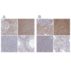 Immunohistochemical staining of human kidney, liver, pancreas and testis using Anti-GSTO1 antibody HPA037604 (A) shows similar protein distribution across tissues to independent antibody HPA037603 (B).