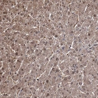 Immunohistochemical staining of human liver shows strong cytoplasmic and nuclear positivity in hepatocytes.