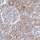 Immunohistochemical staining of human kidney shows moderate cytoplasmic positivity in cells in tubules.