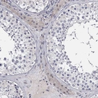 Immunohistochemical staining of human testis shows weak cytoplasmic positivity in Leydig cells as expected.
