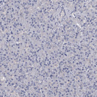 Immunohistochemical staining of human pancreas shows no positivity in exocrine glandular cells as expected.