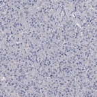 Immunohistochemical staining of human pancreas shows no positivity in exocrine glandular cells as expected.