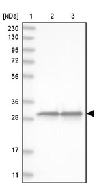 Lane 1: Marker [kDa] 230, 130, 95, 72, 56, 36, 28, 17, 11_br/_Lane 2: Human cell line RT-4_br/_Lane 3: Human cell line U-251MG sp