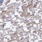 Anti-C11orf21 Antibody