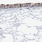 Immunohistochemical staining of human nasopharynx shows strong positivity in cilia in respiratory epithelial cells.
