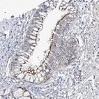 Immunohistochemical staining of human bronchus shows moderate to strong positivity in cilia in respiratory epithelial cells.