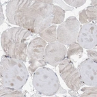 Immunohistochemical staining of human skeletal muscle shows no positivity in myocytes as expected.
