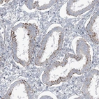 Immunohistochemical staining of human endometrium shows strong positivity in cilia in glandular cells.