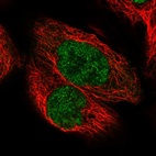 Immunofluorescent staining of human cell line A-431 shows localization to nucleoplasm.