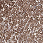 Anti-PIK3C2A Antibody