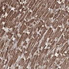 Anti-PIK3C2A Antibody