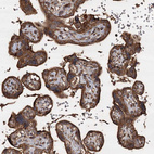 Immunohistochemical staining of human placenta shows strong granular cytoplasmic positivity in trophoblastic cells.
