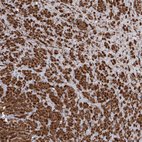 Immunohistochemical staining of human prostate shows strong granular cytoplasmic positivity in smooth muscle cells.