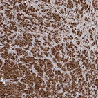 Immunohistochemical staining of human prostate shows strong granular cytoplasmic positivity in smooth muscle cells.