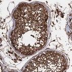 Immunohistochemical staining of human testis shows strong granular cytoplasmic positivity in cells in seminiferous ducts.
