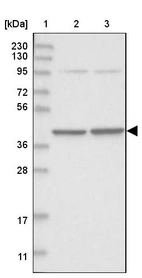 Lane 1: Marker [kDa] 230, 130, 95, 72, 56, 36, 28, 17, 11_br/_Lane 2: Human cell line RT-4_br/_Lane 3: Human cell line U-251MG sp