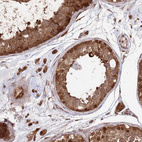 Anti-PSMA1 Antibody