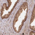 Anti-PSMA1 Antibody