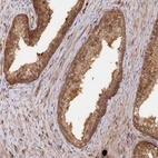 Immunohistochemical staining of human prostate shows moderate to strong nuclear positivity in glandular cells.