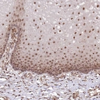 Immunohistochemical staining of human cervix, uterine shows moderate to strong nuclear positivity in squamous epithelial cells.